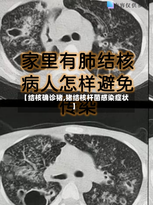 【结核确诊猪,猪结核杆菌感染症状】-第2张图片