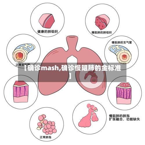 【确诊mash,确诊慢阻肺的金标准】