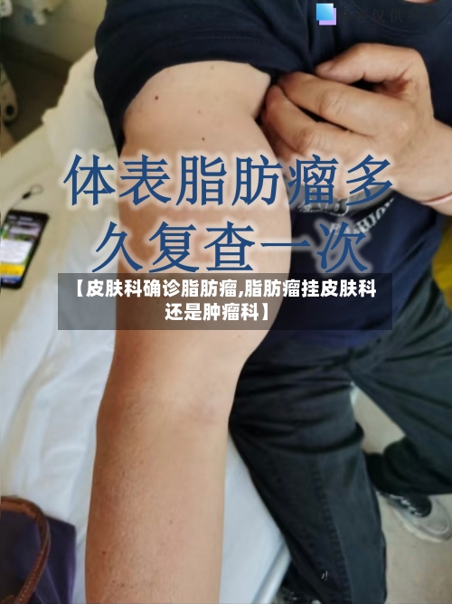 【皮肤科确诊脂肪瘤,脂肪瘤挂皮肤科还是肿瘤科】