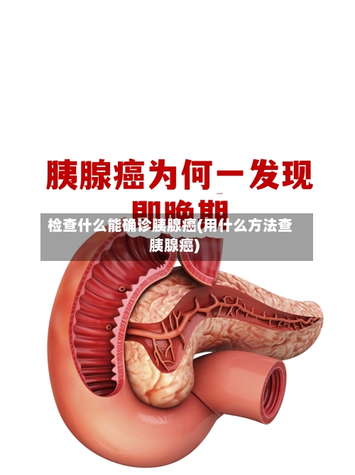 检查什么能确诊胰腺癌(用什么方法查胰腺癌)