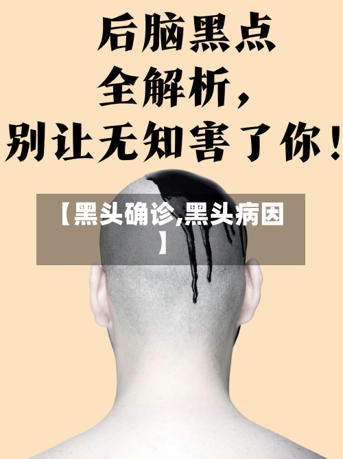 【黑头确诊,黑头病因】-第2张图片