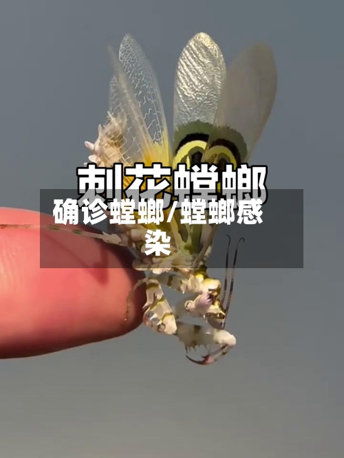 确诊螳螂/螳螂感染