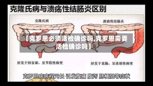 【克罗恩必须活检确诊吗,克罗恩需要活检确诊吗】