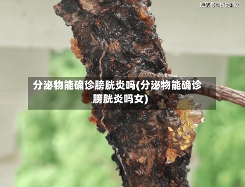 分泌物能确诊膀胱炎吗(分泌物能确诊膀胱炎吗女)-第2张图片