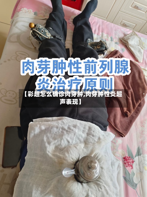【彩超怎么确诊肉芽肿,肉芽肿性炎超声表现】-第3张图片
