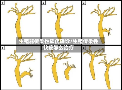 生殖器传染性软疣确诊/生殖传染性软疣怎么治疗-第2张图片