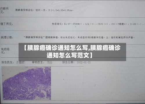 【胰腺癌确诊通知怎么写,胰腺癌确诊通知怎么写范文】