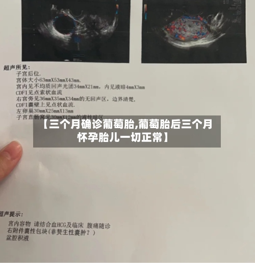 【三个月确诊葡萄胎,葡萄胎后三个月怀孕胎儿一切正常】
