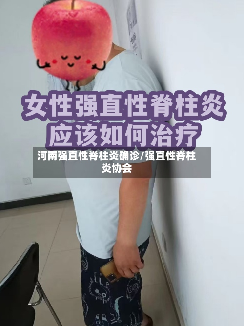 河南强直性脊柱炎确诊/强直性脊柱炎协会