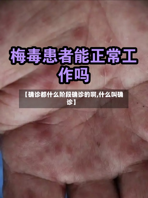 【确诊都什么阶段确诊的啊,什么叫确诊】-第2张图片