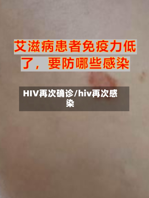 HIV再次确诊/hiv再次感染-第2张图片