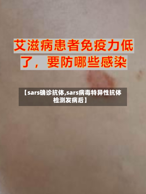【sars确诊抗体,sars病毒特异性抗体检测发病后】