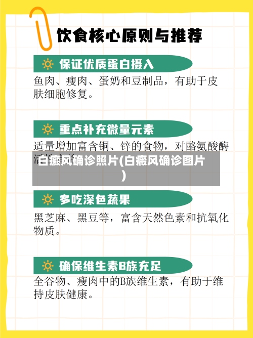 白癜风确诊照片(白癜风确诊图片)