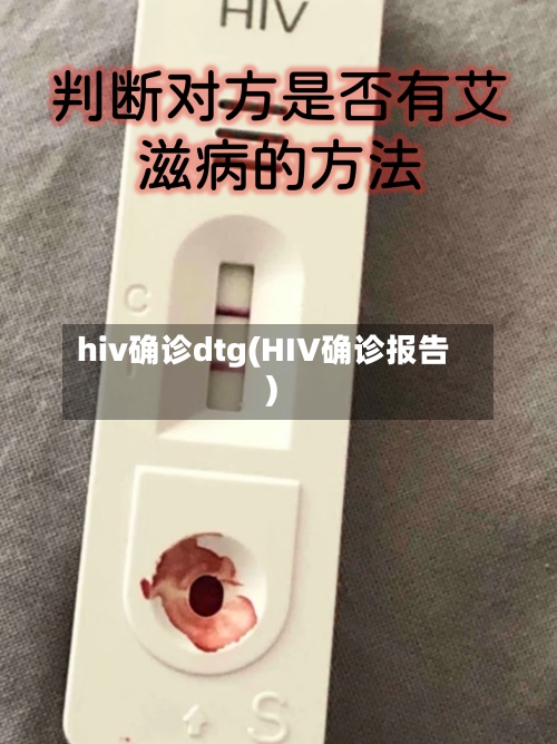 hiv确诊dtg(HIV确诊报告)-第3张图片