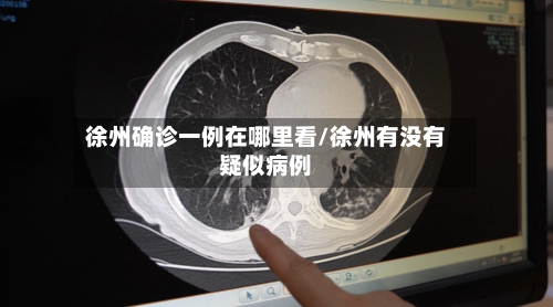 徐州确诊一例在哪里看/徐州有没有疑似病例-第3张图片