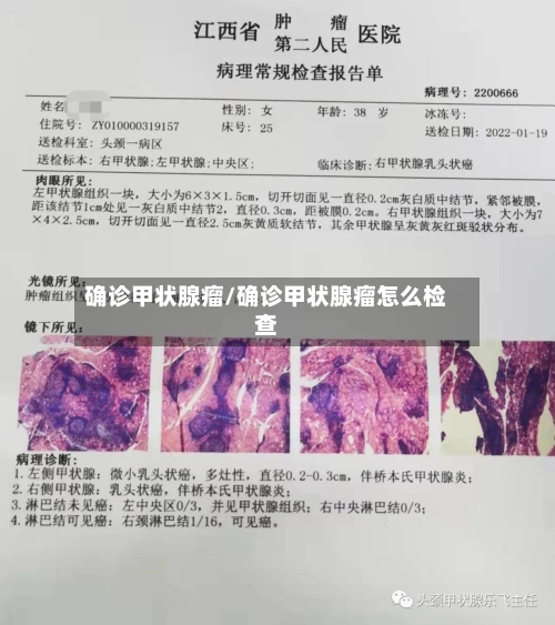 确诊甲状腺瘤/确诊甲状腺瘤怎么检查