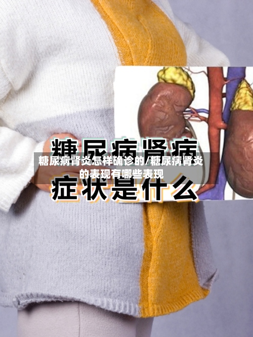 糖尿病肾炎怎样确诊的/糖尿病肾炎的表现有哪些表现-第2张图片