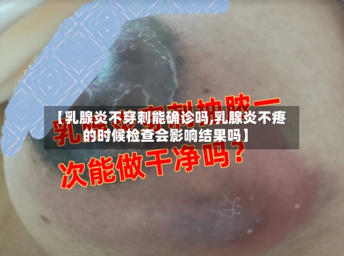 【乳腺炎不穿刺能确诊吗,乳腺炎不疼的时候检查会影响结果吗】-第2张图片