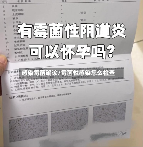 感染霉菌确诊/霉菌性感染怎么检查-第2张图片