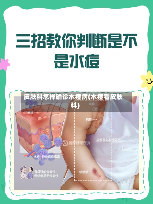 皮肤科怎样确诊水痘病(水痘看皮肤科)