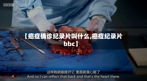 【癌症确诊纪录片叫什么,癌症纪录片bbc】-第3张图片