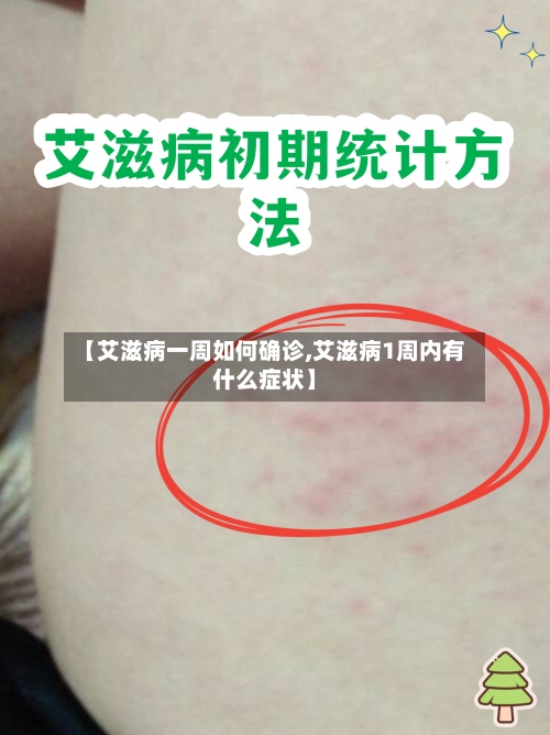 【艾滋病一周如何确诊,艾滋病1周内有什么症状】