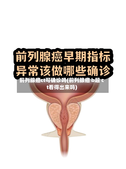 前列腺癌ct可确诊吗(前列腺癌 b超 ct看得出来吗)