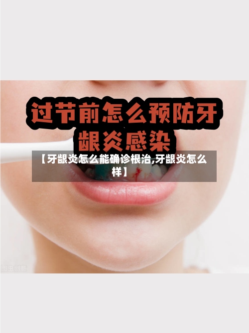 【牙龈炎怎么能确诊根治,牙龈炎怎么样】-第2张图片