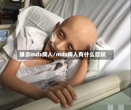 确诊mds病人/mds病人有什么症状