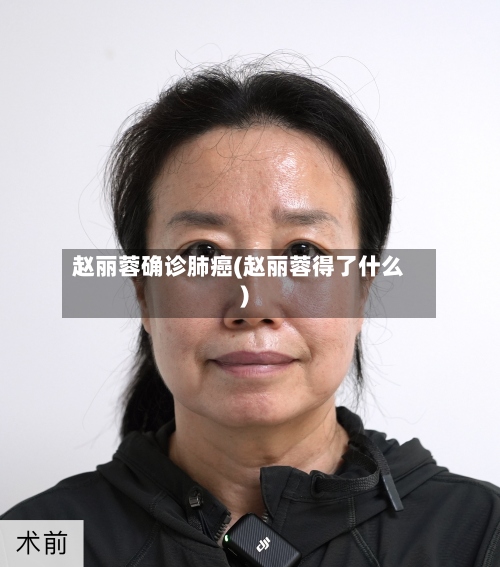 赵丽蓉确诊肺癌(赵丽蓉得了什么)-第3张图片