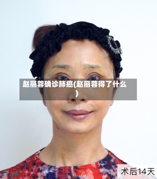 赵丽蓉确诊肺癌(赵丽蓉得了什么)