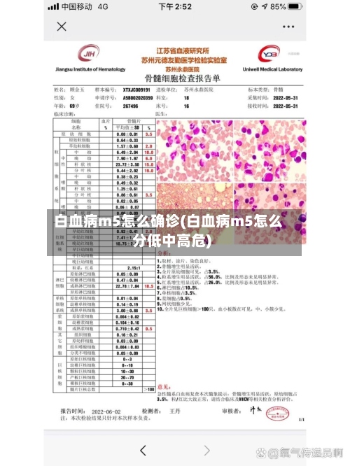 白血病m5怎么确诊(白血病m5怎么分低中高危)