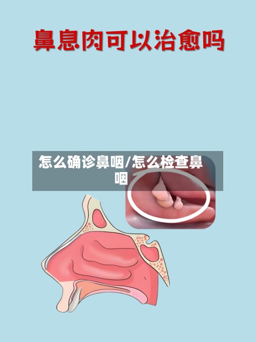 怎么确诊鼻咽/怎么检查鼻咽