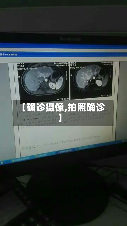 【确诊摄像,拍照确诊】-第2张图片