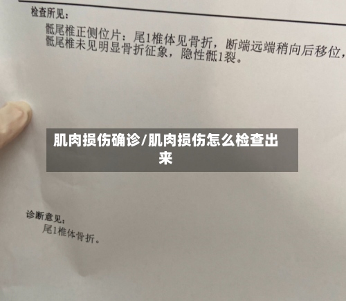 肌肉损伤确诊/肌肉损伤怎么检查出来-第2张图片