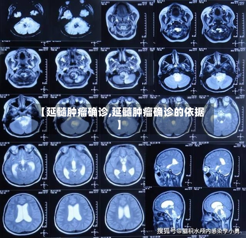 【延髓肿瘤确诊,延髓肿瘤确诊的依据】-第3张图片