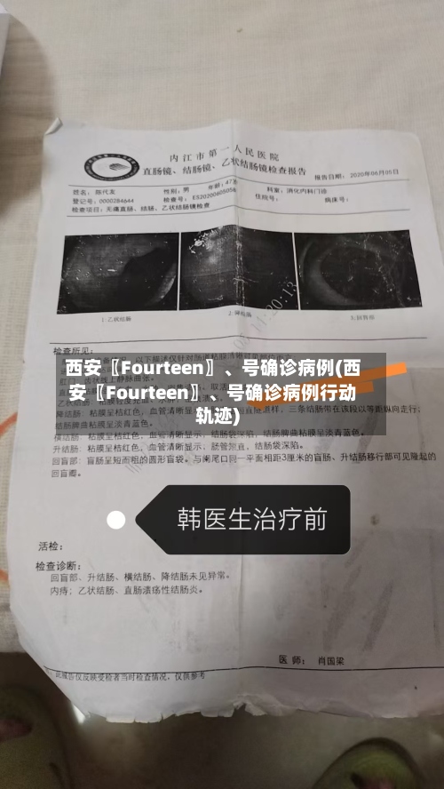 西安〖Fourteen〗	、号确诊病例(西安〖Fourteen〗、号确诊病例行动轨迹)-第3张图片