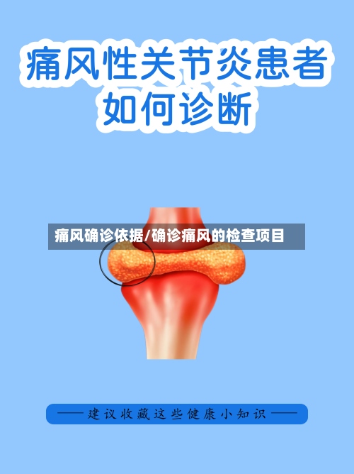 痛风确诊依据/确诊痛风的检查项目