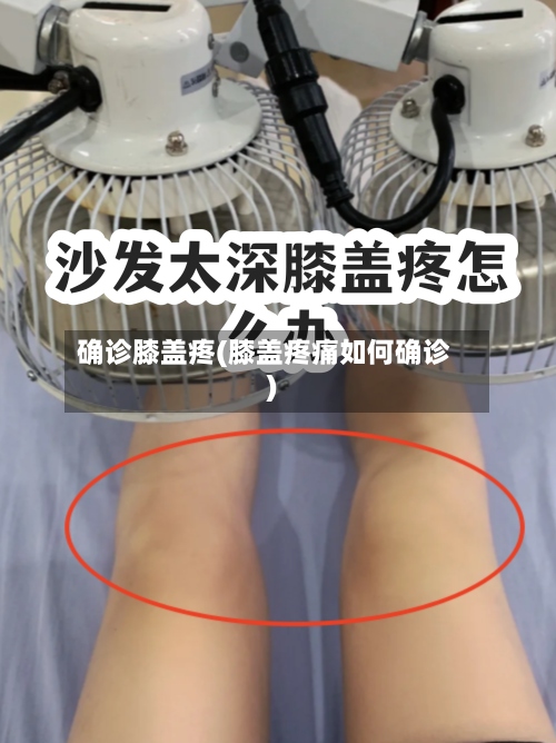 确诊膝盖疼(膝盖疼痛如何确诊)-第3张图片