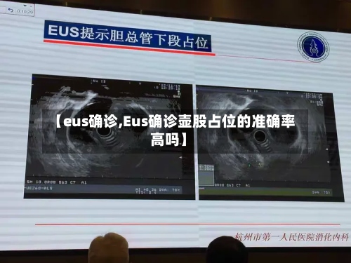 【eus确诊,Eus确诊壶股占位的准确率高吗】