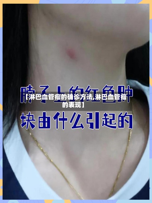 【淋巴血管瘤的确诊方法,淋巴血管瘤的表现】-第2张图片