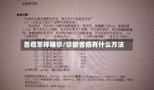 舌癌怎样确诊/诊断舌癌有什么方法-第2张图片