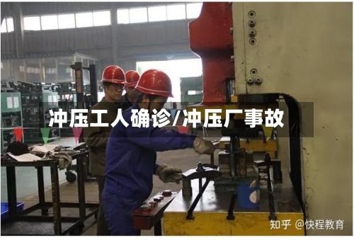 冲压工人确诊/冲压厂事故