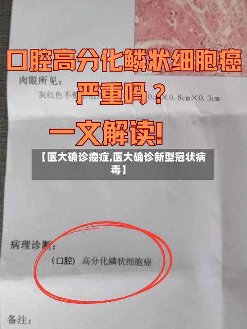 【医大确诊癌症,医大确诊新型冠状病毒】