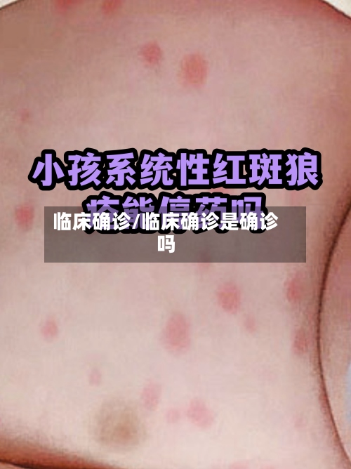 临床确诊/临床确诊是确诊吗