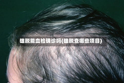 雄脱能血检确诊吗(雄脱查哪些项目)-第2张图片