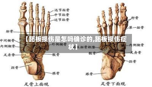 【跖板损伤是怎吗确诊的,跖板损伤症状】-第2张图片