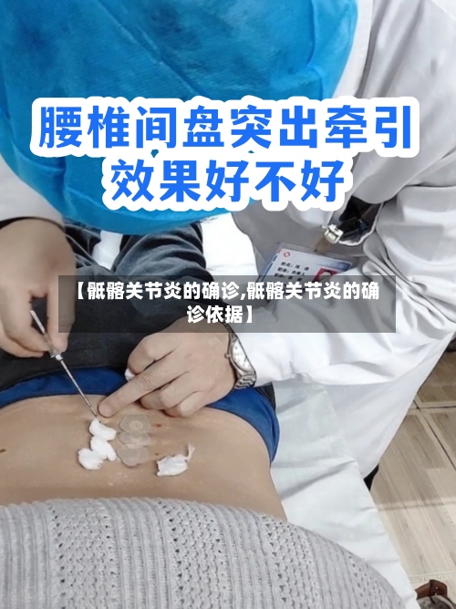 【骶髂关节炎的确诊,骶髂关节炎的确诊依据】-第3张图片