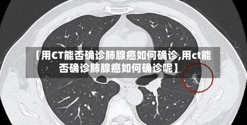 【用CT能否确诊肺腺癌如何确诊,用ct能否确诊肺腺癌如何确诊呢】-第2张图片