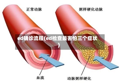 ed确诊流程(ed检查最害怕三个症状)-第3张图片